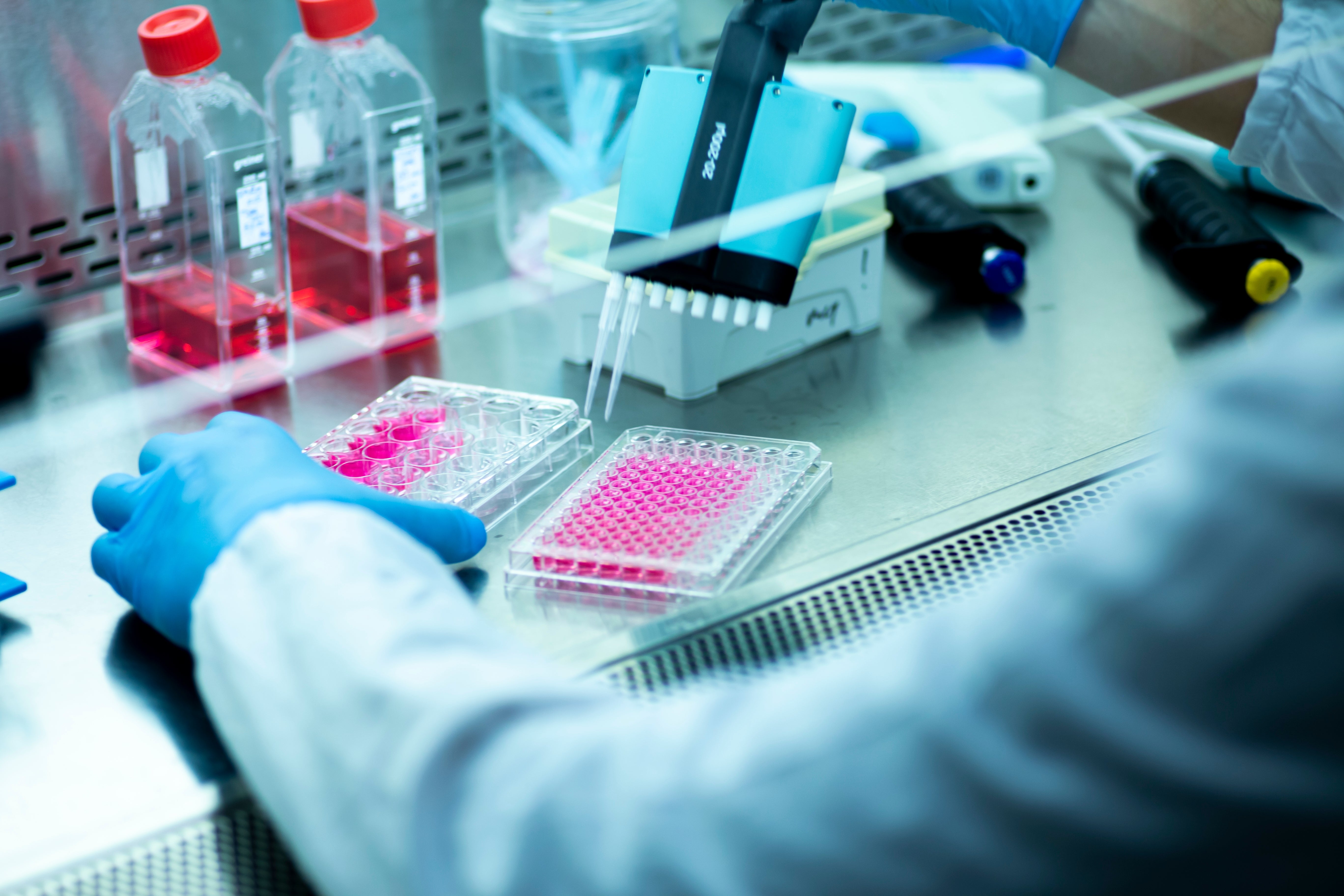 Invasive Testing NIPT (Non-invasive Prenatal Testing) – Pregstem